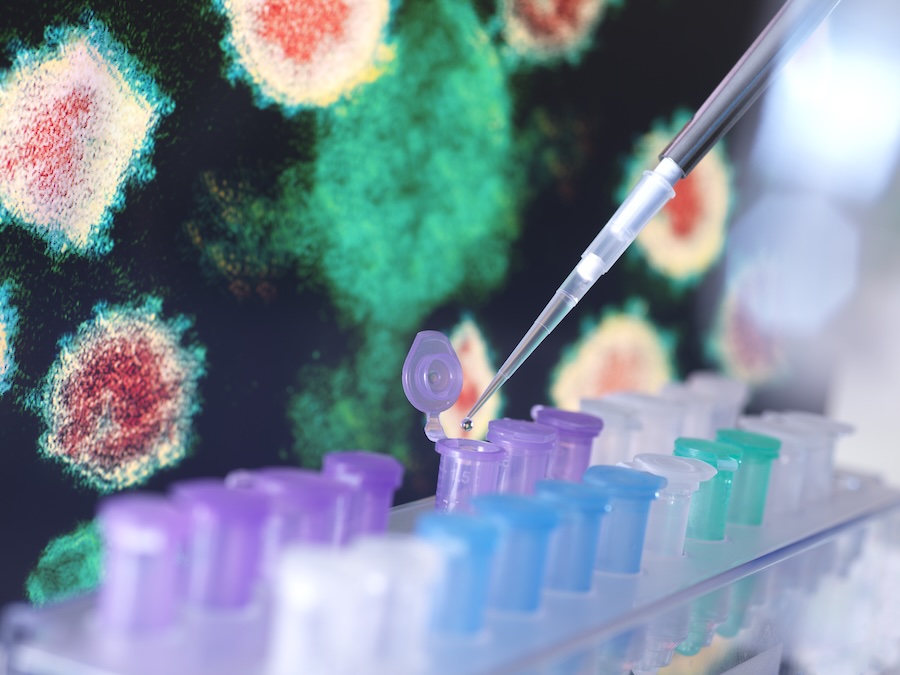 A pipette dispenses liquid into a small plastic tube in a laboratory setting, with colorful capped tubes in a rack and blurred virus-like structures displayed on a screen in the background.